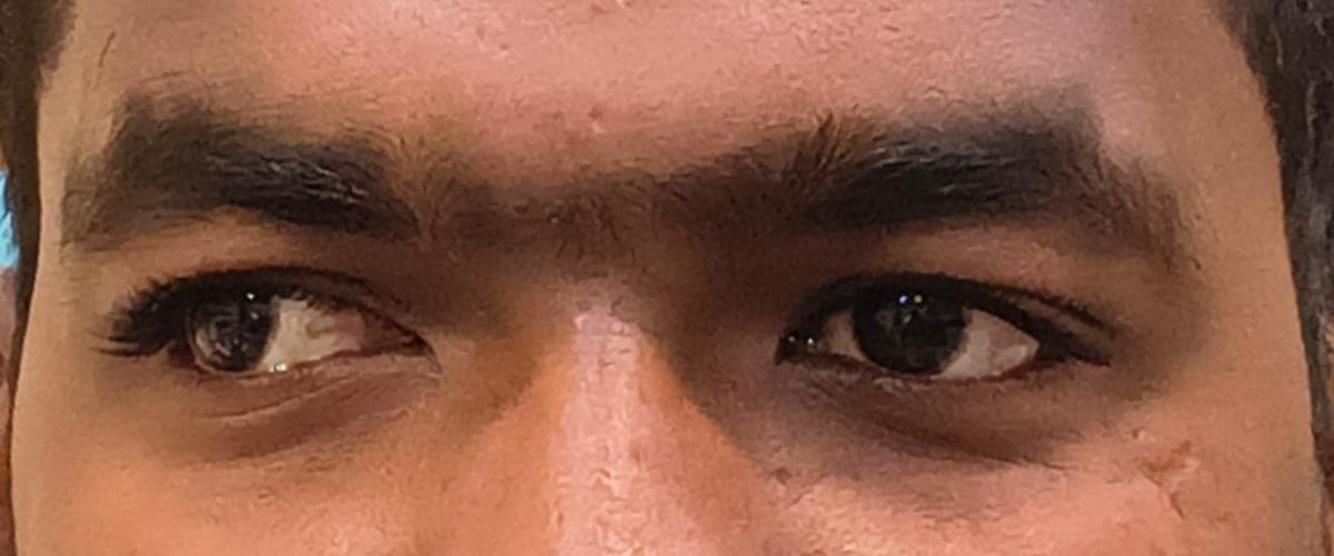 Before: the eyes are not aligned and point in slightly different directions.